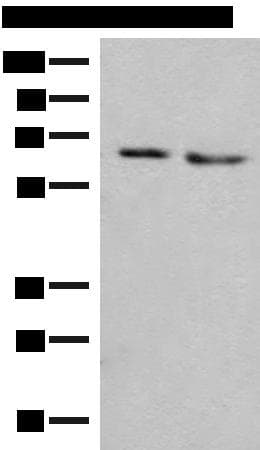 NARS Antibody