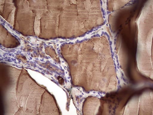 TG / Thyroglobulin Antibody (aa20-358, clone OTI8F2)