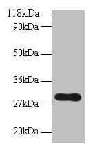 POMC / Proopiomelanocortin Antibody