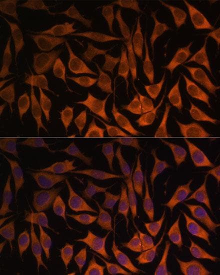 Polyclonal Rabbit anti-Human MRPS35 Antibody (IF, WB)