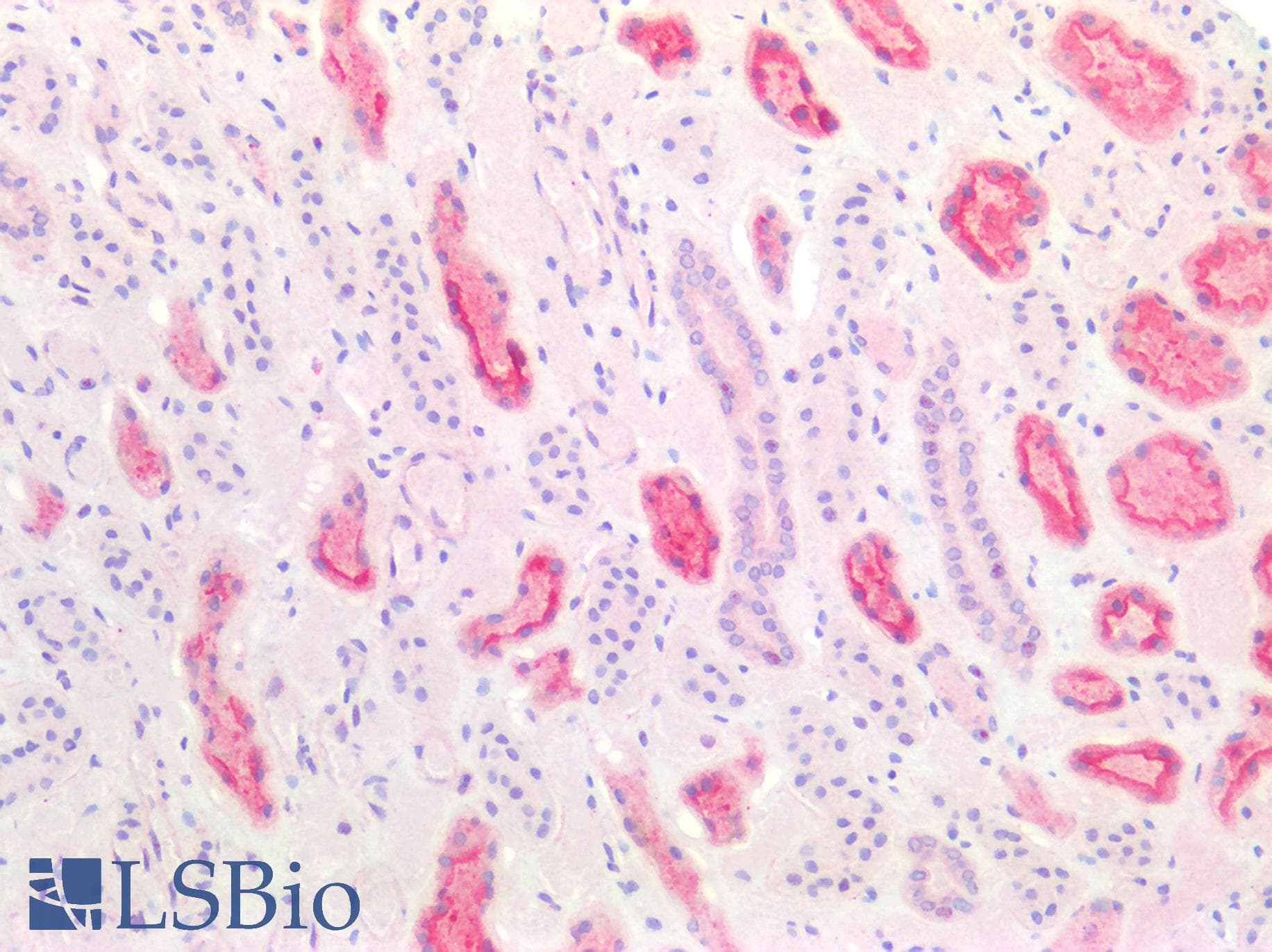 IHC-plus™ VIL1 / Villin Antibody (aa7-246)