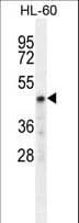 Polyclonal Rabbit anti-Human CHST2 Antibody (aa309-335, WB)