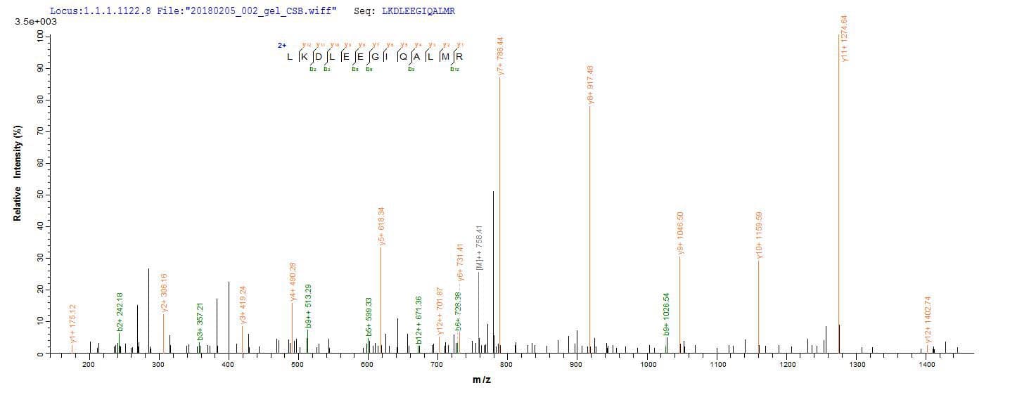 Pig GH / Growth Hormone Protein (Recombinant 10His, N-terminus + Myc, C-terminus)