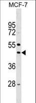 Polyclonal Rabbit anti-Mouse STK32A Antibody (aa347-374, WB)