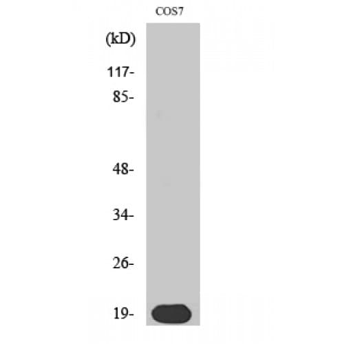 SKP1 Antibody (10-90 aa, Internal)