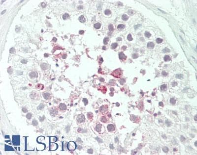PathPlus™ ADORA2A/Adenosine A2A Receptor Antibody (Internal)
