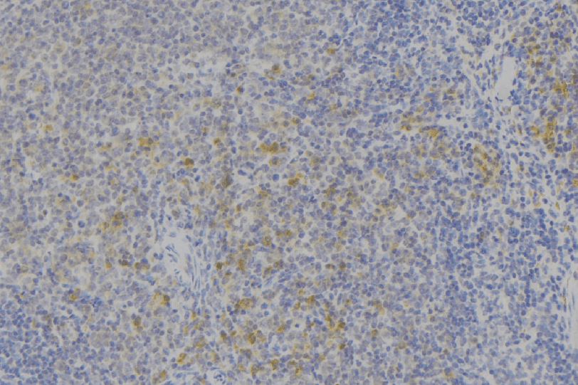 Polyclonal Rabbit anti-Human IFNAR2 Antibody (IHC, WB)
