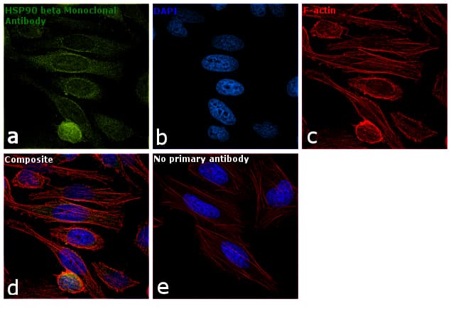 HSP90 / Heat Shock Protein 90 Antibody (clone MBH90B)