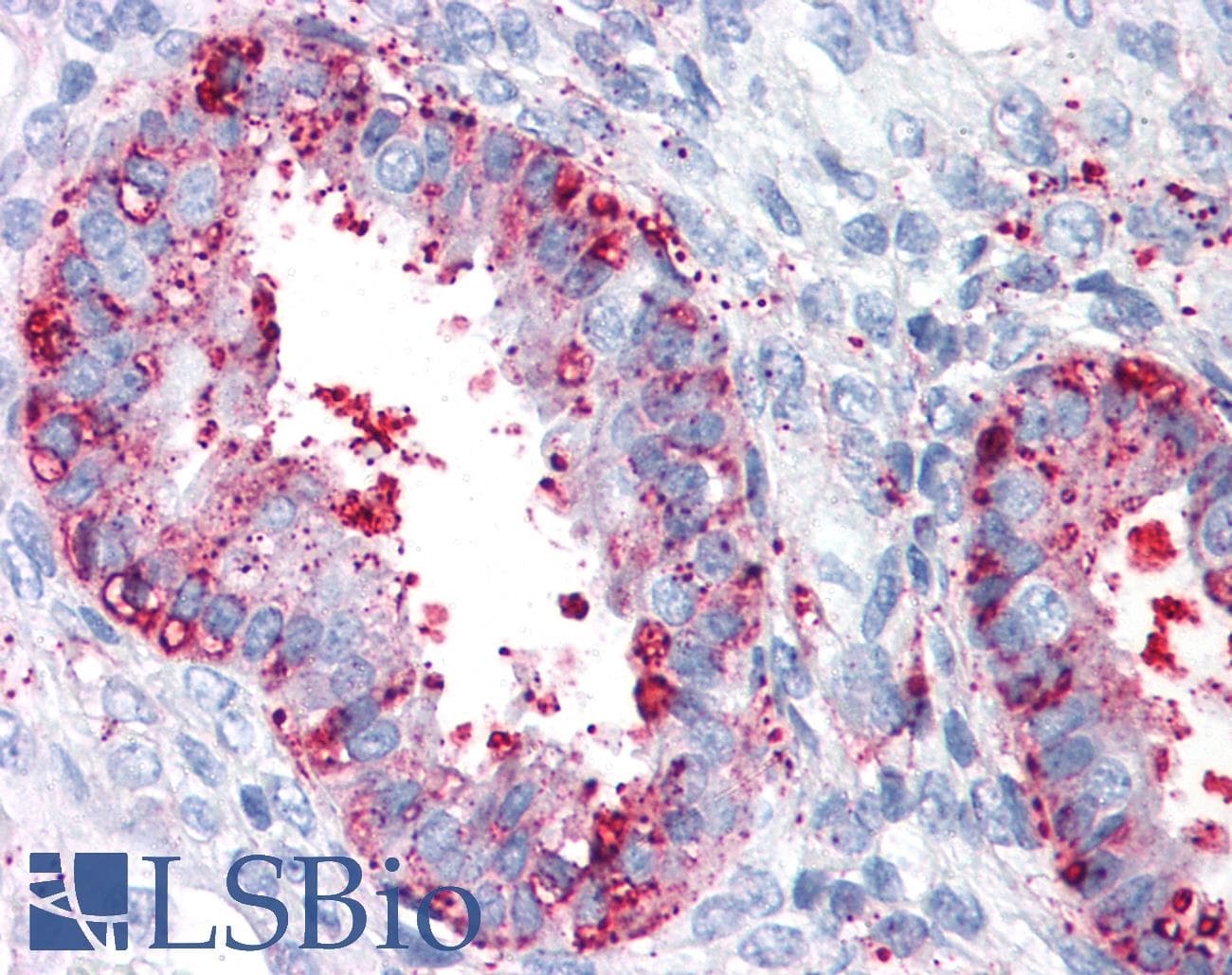 IHC-plus™ Polyclonal Rabbit anti-Human ENTPD2 Antibody (Internal, IHC)