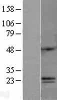 Human C6orf120 Protein (Over-Expression Lysate Myc-DDK (Flag))