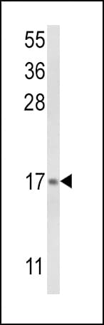 LTC4S / LTC4 Synthase Antibody (aa29-55)