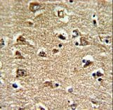 RAN Antibody (aa12-39)