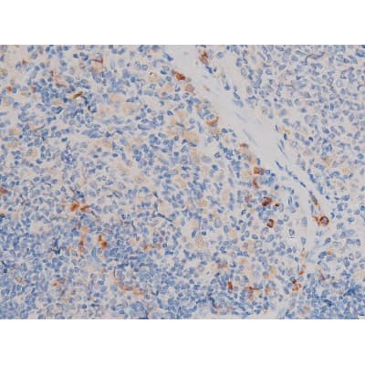 CDC25A Antibody (phospho-Ser75)
