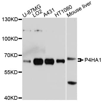 IHC-plus™ Polyclonal Rabbit anti-Human P4HA1 Antibody (IHC, WB)