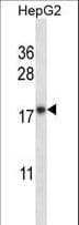 Polyclonal Rabbit anti-Human CYB5A / Cytochrome b5 Antibody (aa69-98, IHC, WB)