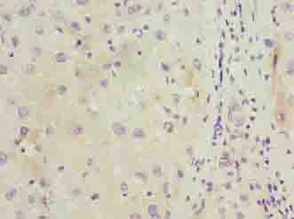 Polyclonal Rabbit anti-Human C11orf53 Antibody (IHC, WB)