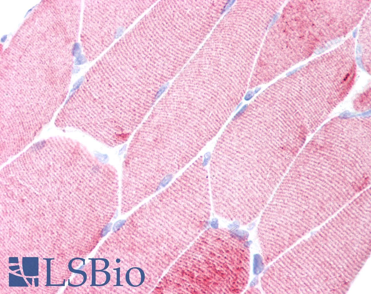 IHC-plus™ ACTA1 / Skeletal Muscle Actin Antibody (clone 3B3)
