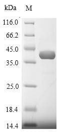 Plasmodium berghei LDHB / Lactate Dehydrogenase B Protein (Recombinant 10His, N-terminus + Myc, C-terminus)
