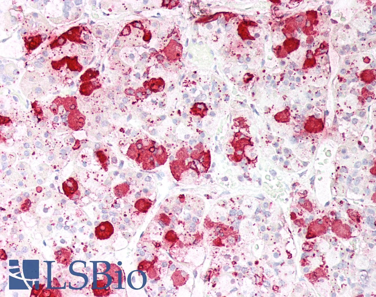 PathPlus™ ACTH Antibody