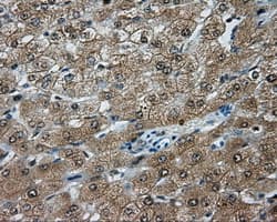 TPMT Antibody (clone OTI5B4)