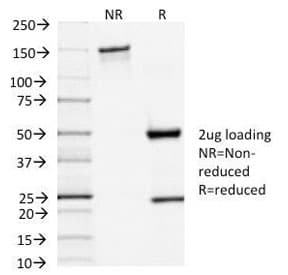 TSH Receptor / TSHR Antibody (clone TSHRA/1402)