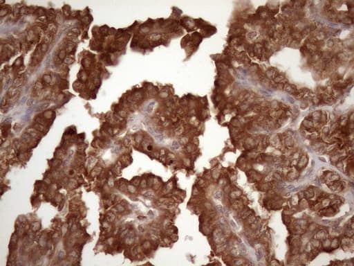 CSF2RB / CD131 Antibody (clone OTI4H3)