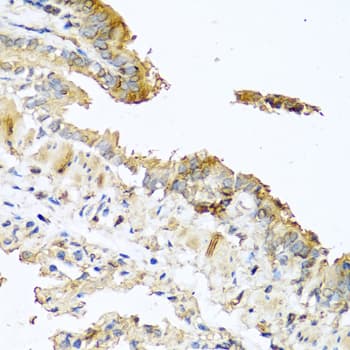 RNASE11 Antibody