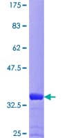 Human GCHFR Protein (Recombinant GST)