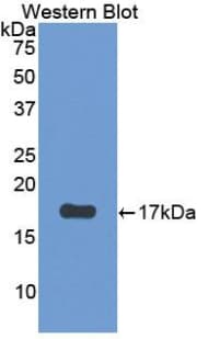 PTHR2 / PTH2R Antibody (aa27-145)