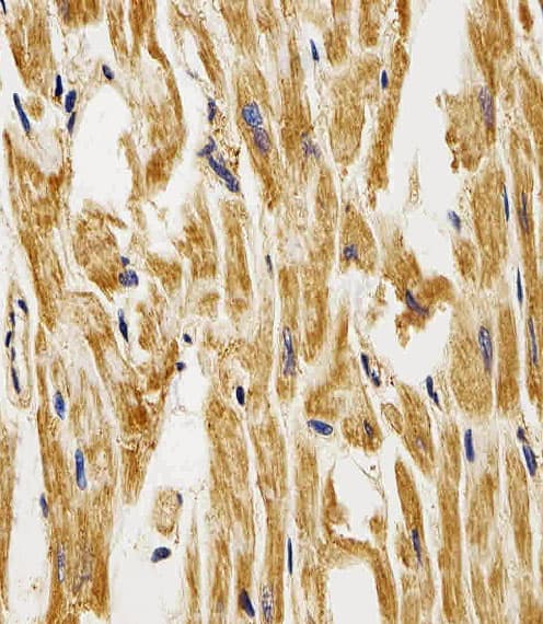 FABP3 / H-FABP Antibody