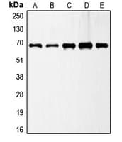 Polyclonal Rabbit anti-Human GAD1 / GAD67 Antibody (C-Terminus, WB)
