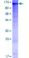 Human WDR47 Protein (Recombinant GST)