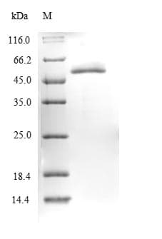 Pseudomonas azotoformans laaA Protein (Recombinant 10His-SUMO, N-terminus + Myc, C-terminus)