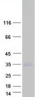 Human TMEPAI / PMEPA1 Protein (Recombinant Myc-DDK (Flag))