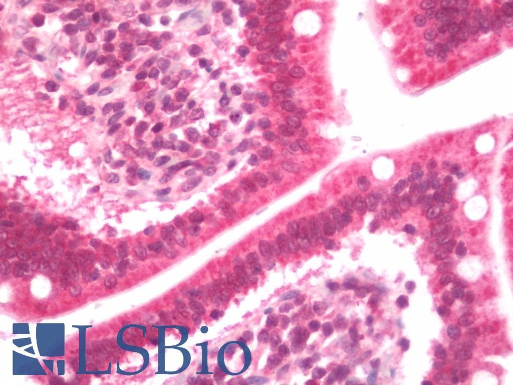 IHC-plus™ CSRP2BP Antibody