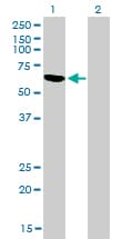 IHC-plus™ RBM5 / G15 Antibody (clone 2B6)