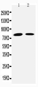 TGM2 / Transglutaminase 2 Antibody (aa399-418)