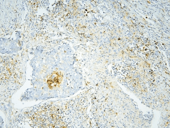 ANXA3 / Annexin A3 Antibody