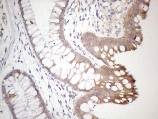 Monoclonal Mouse anti-Human SETD8 / SET8 Antibody (clone OTI2F5, IHC, WB)