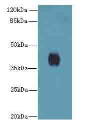 PTAFR / PAF Receptor Antibody