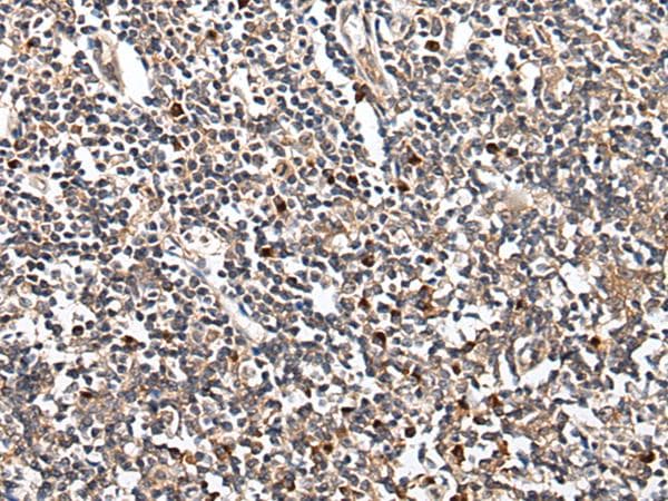HOXB9 Antibody