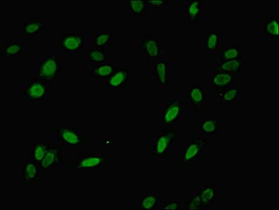 Polyclonal Rabbit anti-Human NIP7 Antibody (aa1-180)