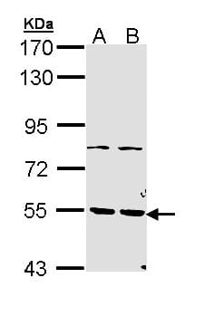 Polyclonal Rabbit anti-Human PDE1A Antibody (aa212-535, IHC, WB)