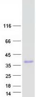 Human IGFBPL1 Protein (Recombinant Myc-DDK (Flag))