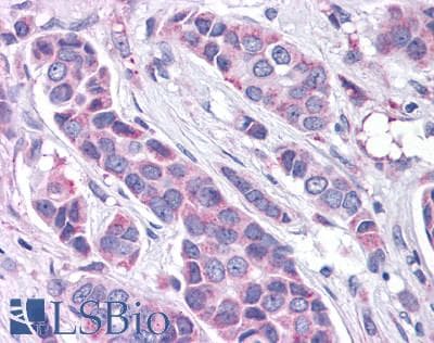 PathPlus™ GPER1 / GPR30 Antibody (N-Terminus)