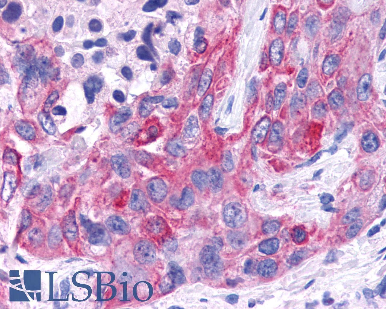 PathPlus™ VPAC2 / VIPR2 Antibody (C-Terminus)