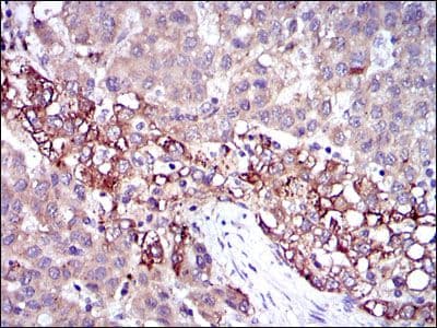 FGG / Fibrinogen Gamma Antibody (clone 4H9)