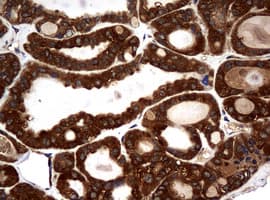 NME1 / NM23 Antibody (clone OTI4G3, Carrier-free)