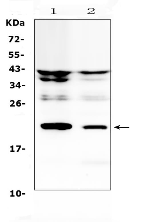 Polyclonal Rabbit anti-Rat IL11 Antibody (WB)