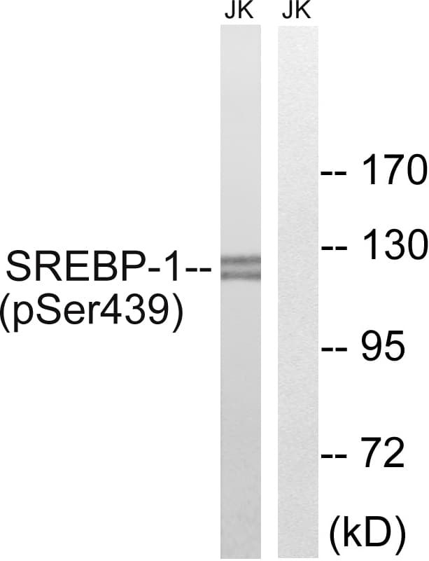 Polyclonal Rabbit anti-Human SREBF1 / SREBP-1 Antibody (phospho-Ser439, IHC, WB)
